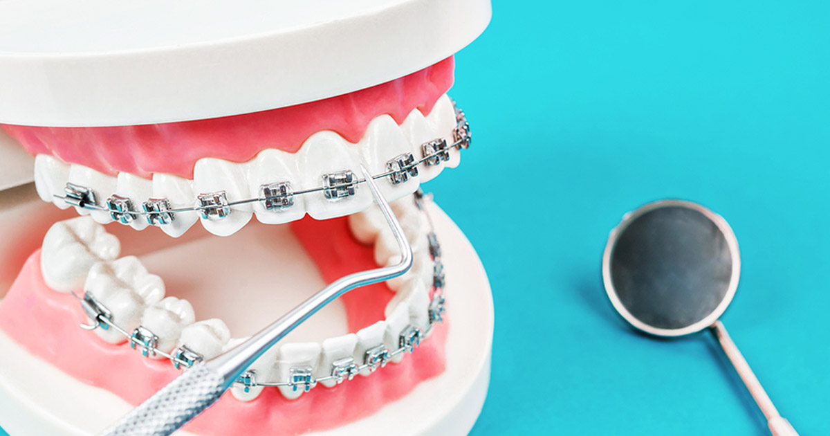 Gray-Orthodontics-1