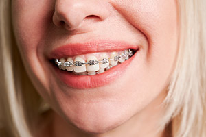 Gray-Orthodontics-3